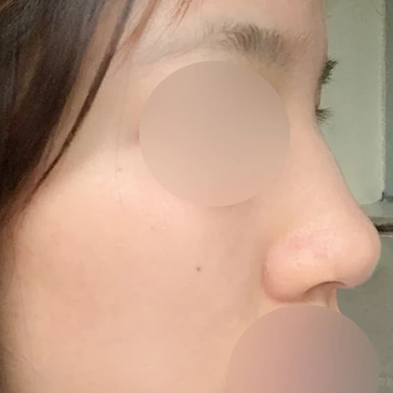 투박한 복코 Before
