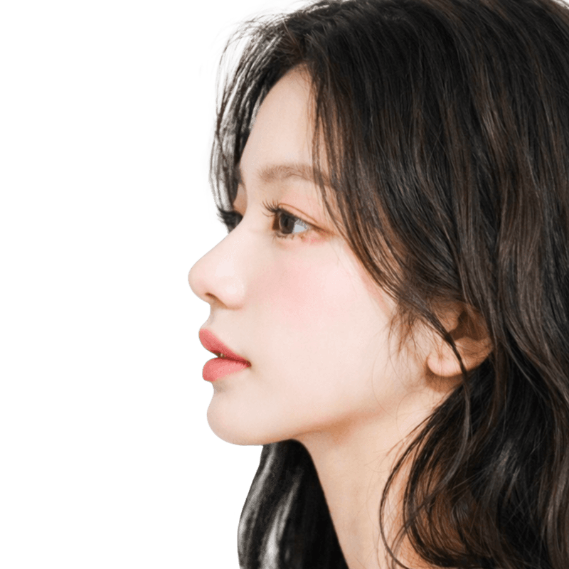 옆 얼굴 비율 다이어그램 — 이마·앞광대·비순각·턱끝 볼륨 포인트