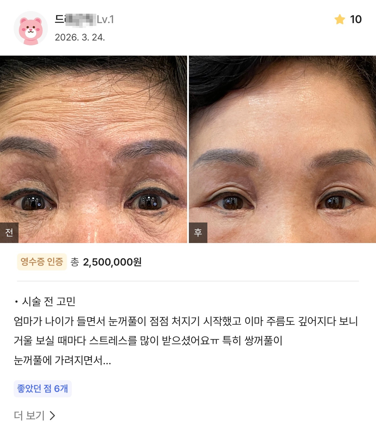 강남언니 게재 환자 후기 2