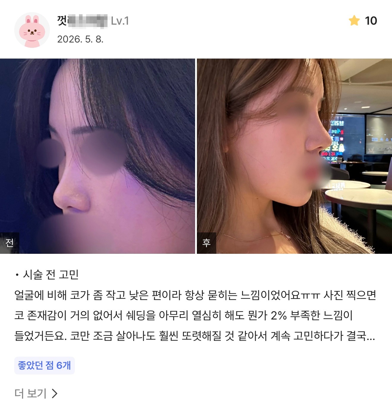 강남언니 게재 환자 후기 3