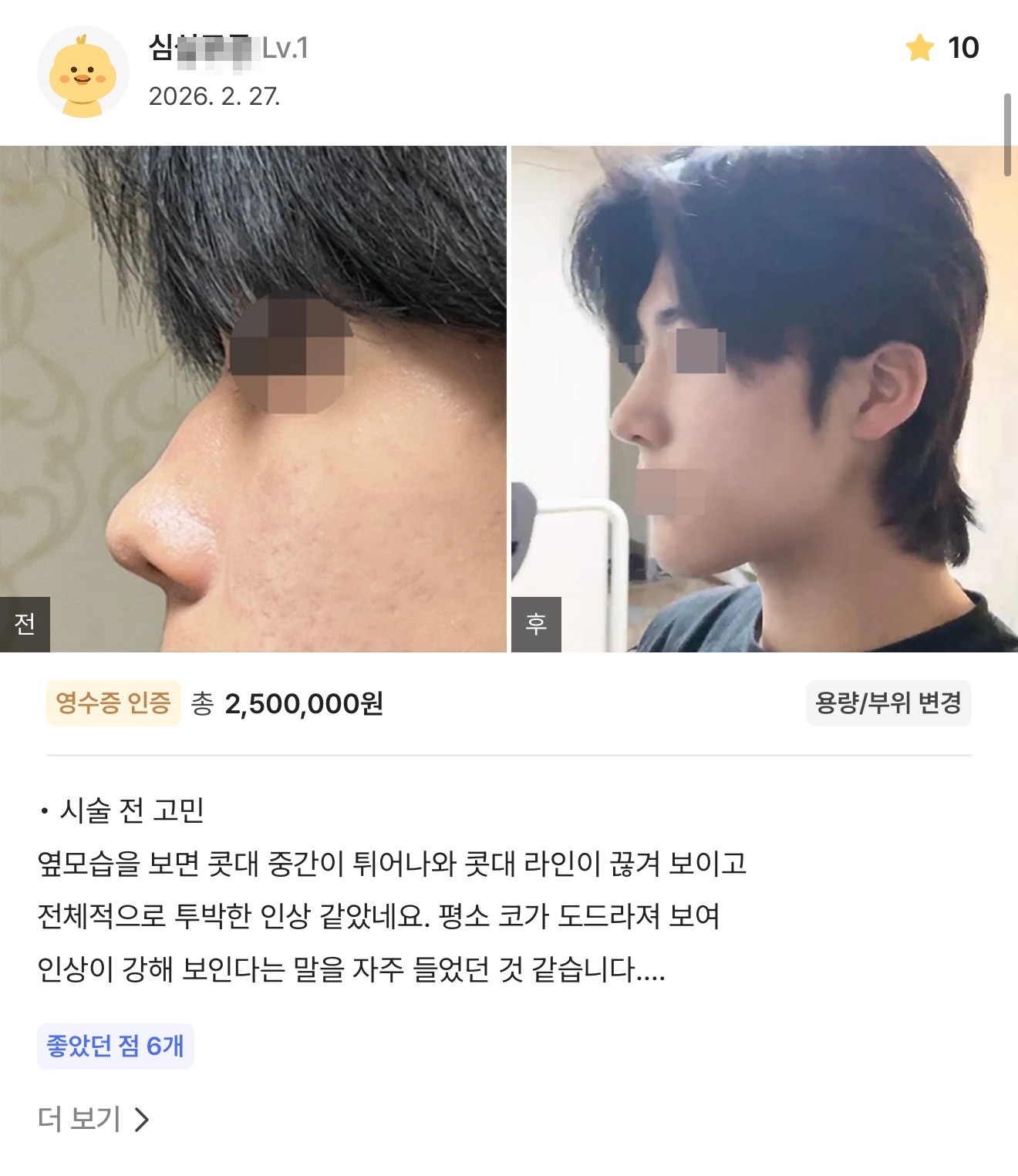 강남언니 게재 환자 후기 7
